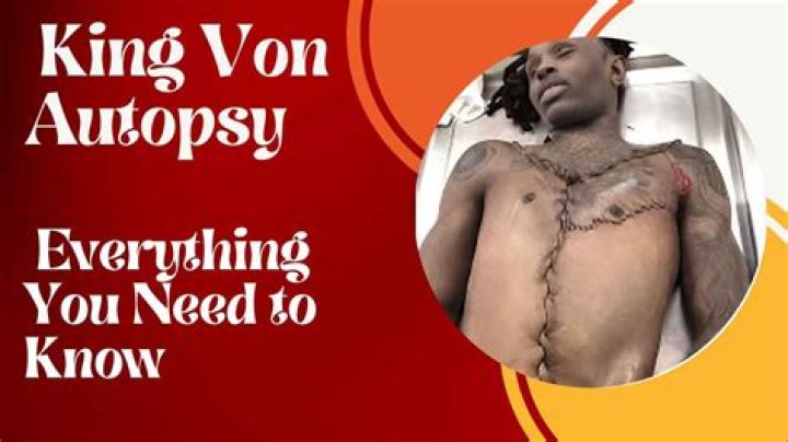 Disturbing Details: King Von Leaked Autopsy Revealed