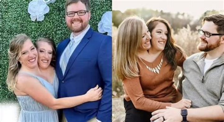 Tragic News: Abby And Brittany Died Giving Birth Today