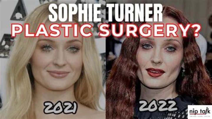 Unveiling The Truth: Did Sophie Rain Get Surgery?