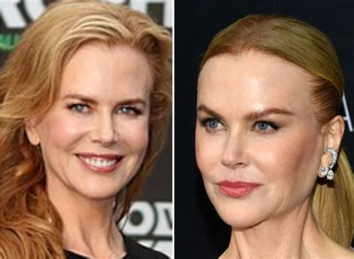 What Color Eyes Does Nicole Kidman Have | Celeb Eyes Color Revealed